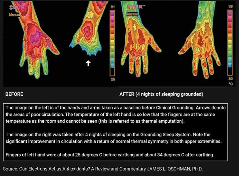 Earthing Therapy Mat + Wristband — Grounding for Sleep, Stress & Body Balance